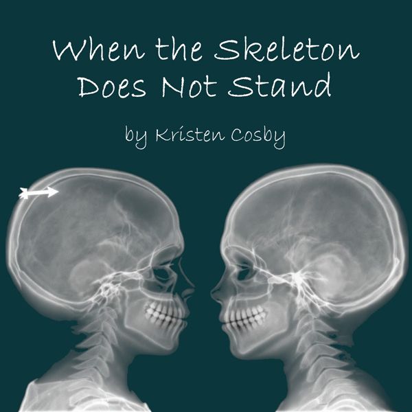 Solo Fest: When the Skeleton Does Not Stand